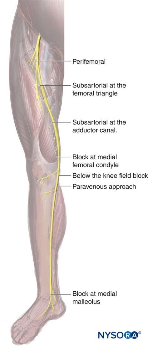 Bloc nerveux saphène canal de l adducteur guidé par ultrasons NYSORA