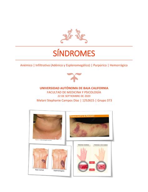 Tarea Hematologia Sindromes Warning Tt Undefined Function