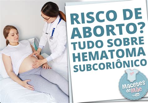 Saiba Tudo Sobre Hematoma Subcori Nico Macetes De M E