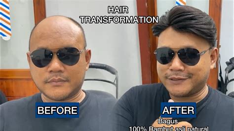 Solusi Rambut Botak Dengan Toupee Hair System Full Lem Rambut