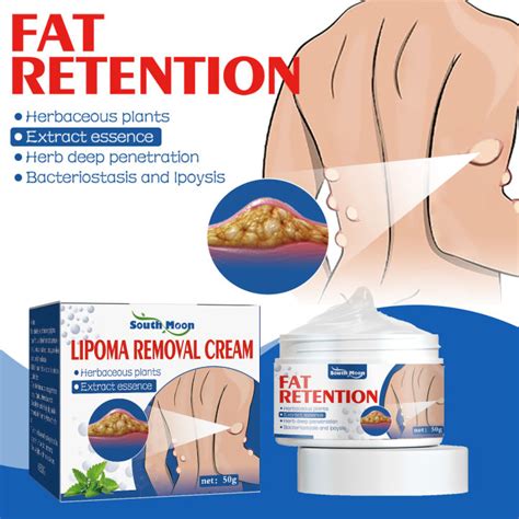 South Moon Lipoma Removal Ointment Treatment Fat Bulges Lump Remove