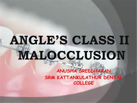 Angles Class Ii Malocclusion Ppt