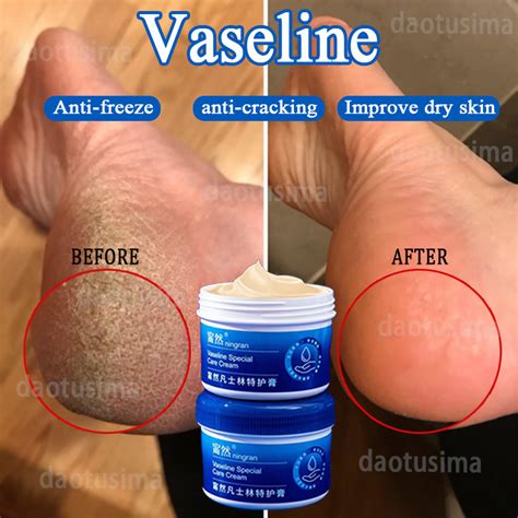 Vaseline Foot Cream Hand Cream Anti Crack Moisturizing Foot Care For