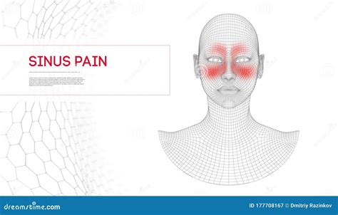 Donna Addolorata Al Naso Infezione Nasale Sinusale Frontale Anatomia