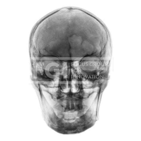 Film X Ray Of Normal Human Skull Front View