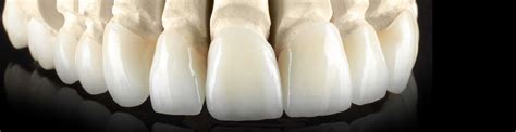 Porcelain Ceramic And Zirconia Crowns Bridges And Inlays Ralev