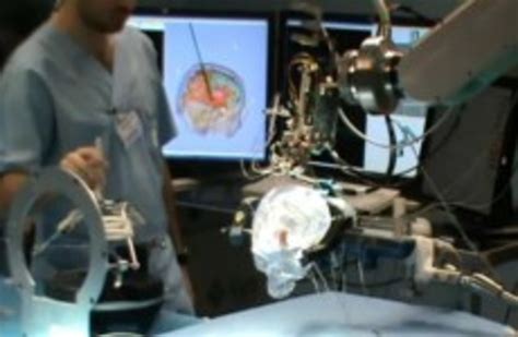 Eu Funded Researchers Make Breakthrough On Robotic Brain Surgery