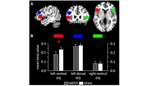 Electric brain stimulation can boost learning speed: Study | Technology ...