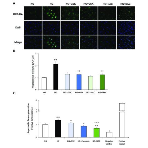 Curcumin Reduces High Glucose Induced CCL2 And VEGF Expression In