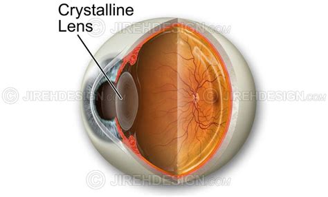 Lens Anatomy - PPT - Cataract and cataract surgery PowerPoint ... : The ...