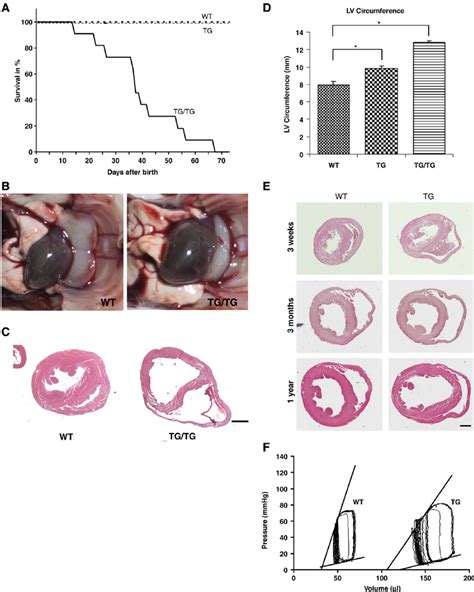 Tgtg Mice Develop Dcm And Die Within Two Months Postnatally From