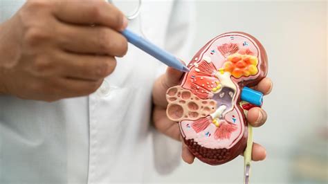 Are Your Daily Habits Harming Your Kidneys Uncover The Common Culprits