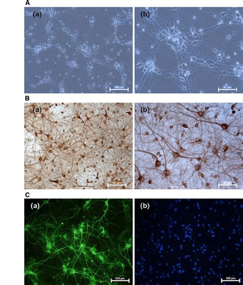 Primary Cultures Of Cortical Neurons A Microscopic Images Of Cortical