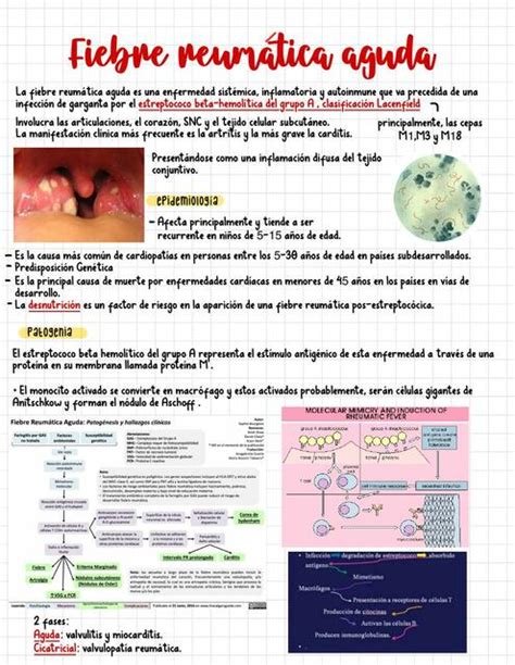 Fiebre reumática aguda lena uDocz