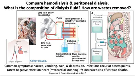 Hemodialysis Vs Peritoneal Dialysis