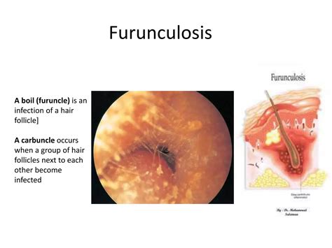 Different Ear Conditions Ppt