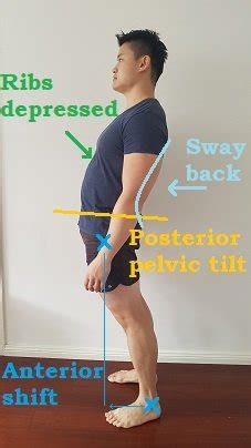 How To Fix Sway Back Posture - Posture Direct