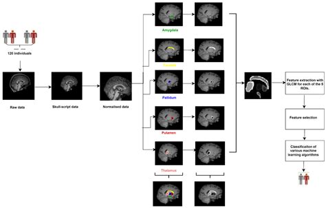 Diagnostics Free Full Text Constructing The Schizophrenia