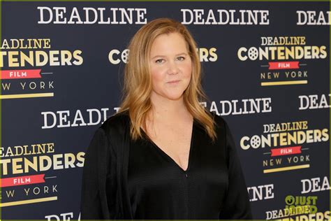 Amy Schumer Explains Endometriosis And Liposuction Procedures Have Helped