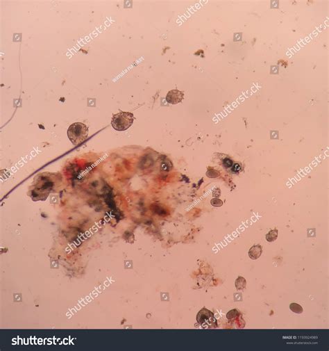 Microscope Showing Sarcoptes Mange Eggs Stock Photo 1193924989 ...