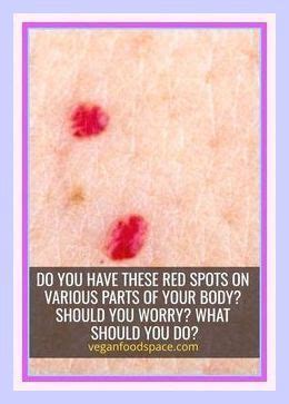 Do You Have These Red Spots On Various Parts Of Your Body Red Spots On