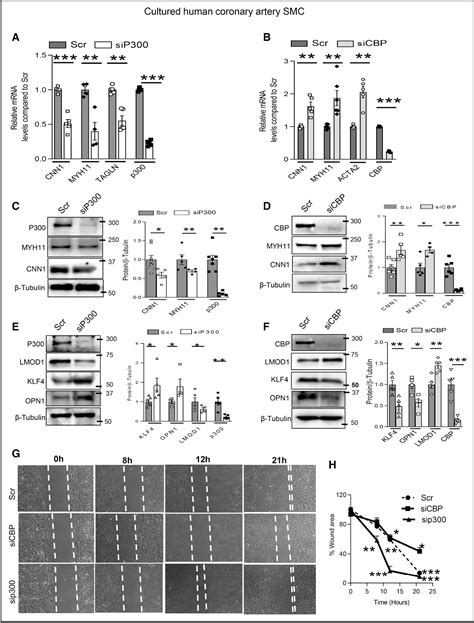 Figure 1 From Histone Acetyltransferases P300 And Cbp Coordinate