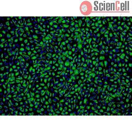 Human Non Pigmented Ciliary Epithelial Cells HNPCEpiC