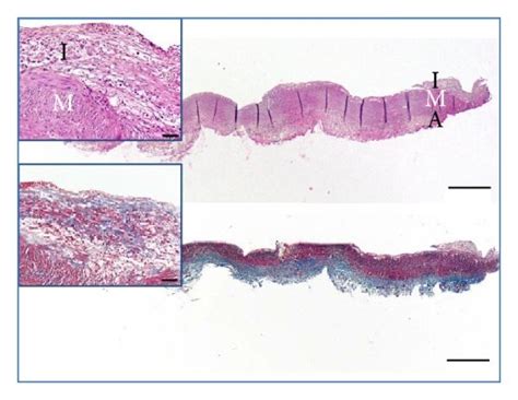 Morphometric Results Panel A And Histologic Characterization