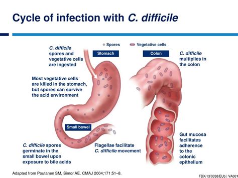 PPT Introduction To Clostridium Difficile Infection PowerPoint