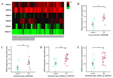 HDAC4 Was Highly Expressed In PD Brain Tissues A Gene Expression