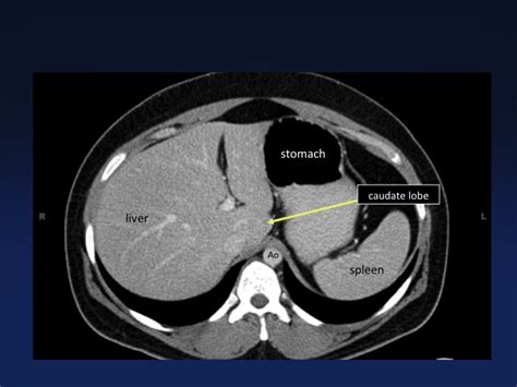 Cross Sectional Anatomy Of The Body Mdct Atlas Ct Scanning