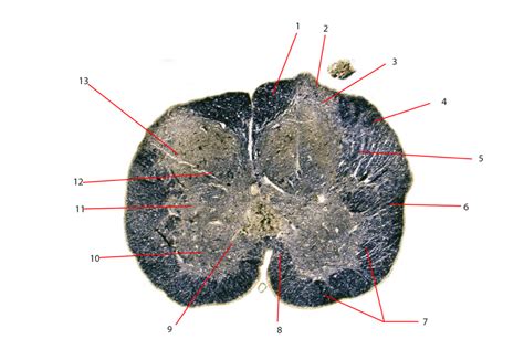 Internal Morphology: Spinal Cord 05 Diagram | Quizlet