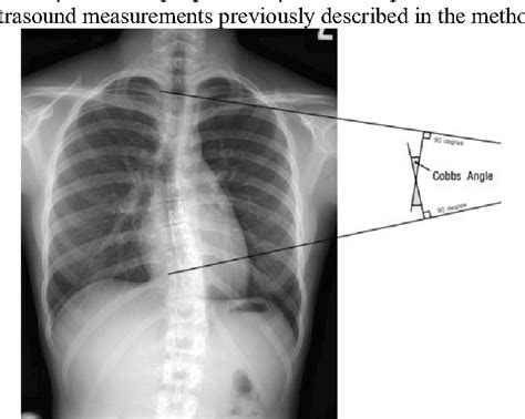 Figure 1 From Inter Tester And Intra Tester Reliability Of Ultrasound