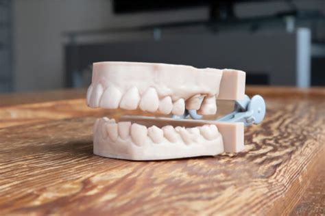 How To Know When You Need Treatment For Jaw Alignment Problems?