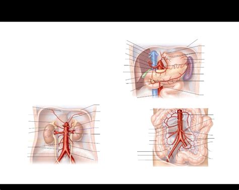 Abdominal Arteries Diagram Quizlet