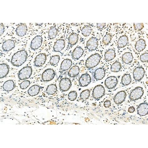 Phospho Erk Thr Tyr Thr Tyr Antibody Affinity