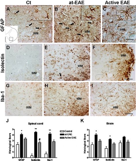 Glial Activation In Lumbar Spinal Cord Astroglial GFAP Immunostaining