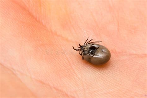 Close Up Photo Of A Tick Couple Male And Female On Human Skin Stock