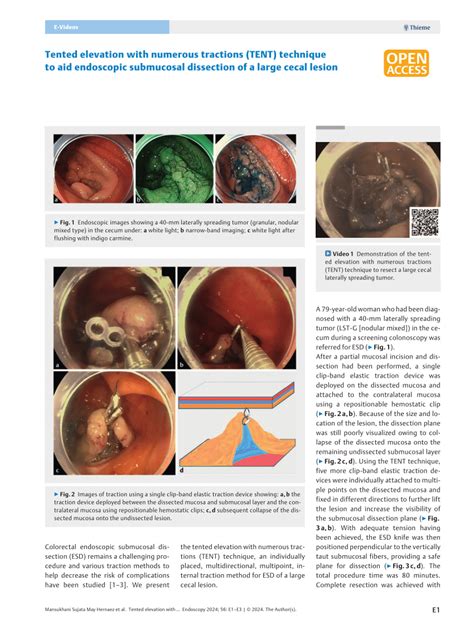 Pdf Tented Elevation With Numerous Tractions Tent Technique To Aid Endoscopic Submucosal