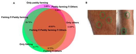 Pathogens Free Full Text Mammalian And Avian Larval Schistosomatids