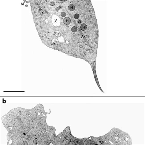 General View Of Trichomonas Vaginalis As Seen By Transmission Electron Download Scientific