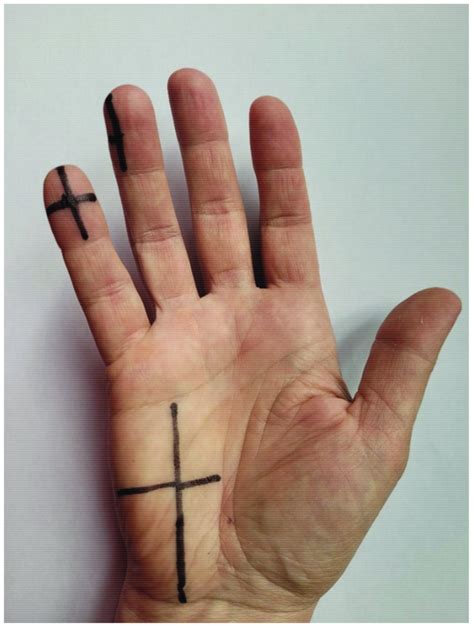 Longitudinal And Transverse Lines To Standardize The Measurements