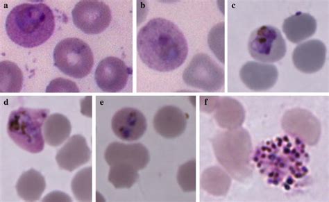 Long Term In Vitro Culture Of Plasmodium Vivax Isolates From Madagascar Maintained In Saimiri