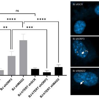 Evaluation Of Prpa Foci Formation Upon Oncogene Induced Replication