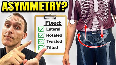 Fix Lateral Pelvic Tilt And Hip Asymmetry Self Test And Exercise