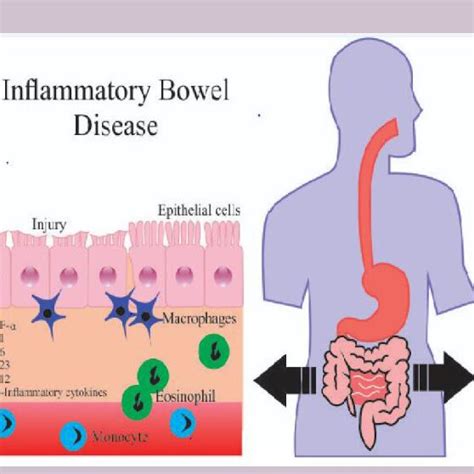 Inhibition Of Epithelial Cells In Ibd Due To The Increase Of Download Scientific Diagram