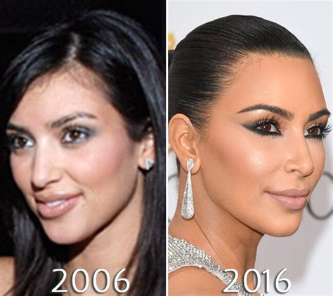 Kardashians before and after photos