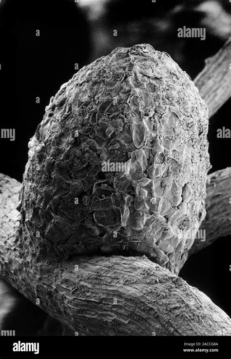 Scanning Electron Micrograph Of A Root Nodule On The White Clover Plant