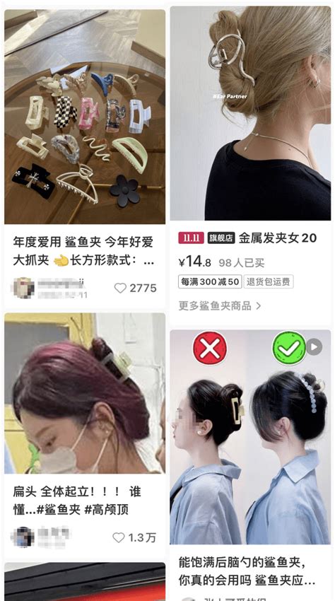 13岁女孩戴着它摔倒，头皮缝了3针！这个发饰，很多女孩天天都在戴鲨鱼头发发夹