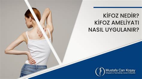 Kifoz Nedir Kifoz Ameliyatı Nasıl Uygulanır Prof Dr Can Koşay